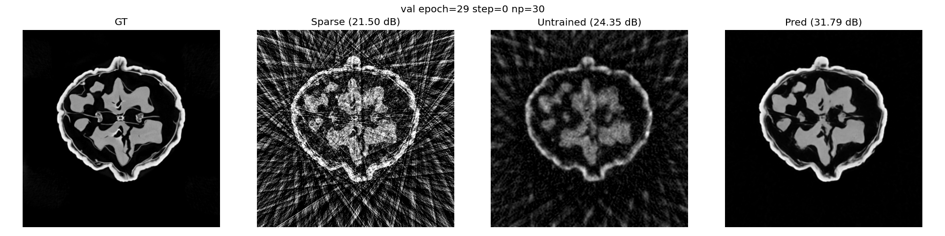 Comparaison qualitative des reconstructions : données de référence (GT), modèle de base clairsemé, sortie d'un réseau non entraîné et prédiction d'un réseau entraîné et « unrolled »
